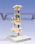 6 Mounted Vertebrae, atlas, axis, another cervical vertebra, two thoracic vertebrae with inter-vertebral discs and one lumbar vertebra